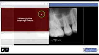 Training Apteryx XVWeb 20  How to Acquire a Single Periapical in XVCapture [upl. by Ynagoham]