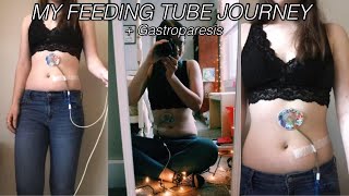 Feeding Tube Awareness Week 2022 My PEGJ Tube and Gastroparesis Journey [upl. by Suruat]