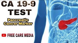 CA 199 test in malayalam  pancreatic cancer marker [upl. by Sylram106]