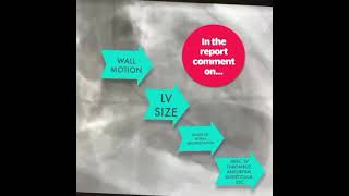 Basics of Ventriculography [upl. by Oiludbo]