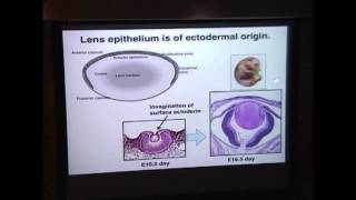 EpithelialMesenchymal Transition EMT The Key Phenomenon in Ocular Fibrotic Disease [upl. by Bounds852]