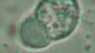 Chlamydiosis Chlamydia trachomatis [upl. by Saiff]