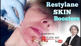 Restylane Skin Boosters [upl. by Pandora]