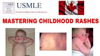 MASTERING CHILDHOOD RASHES MEASLES RUBELLA ROSEOLA SCARLET FEVER USMLE MCC CLINICAL MEDICINE [upl. by Yrbua]