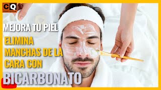 COMO quitar MANCHAS de la CARA con BICARBONATO y LIMON  Remedio casero efectivo [upl. by Gianina795]