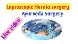 Laproscopic Hernia surgery TAPP  Ayurveda Surgery [upl. by Neelat]