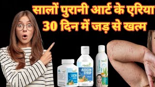 सालों पुरानी urticaria 30 दिन में जड़ से खत्म urticaria livcon capsule and assicon syrup urticaria [upl. by Luckett752]