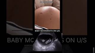 9 Months Pregnancy Baby Movement [upl. by Imaj]