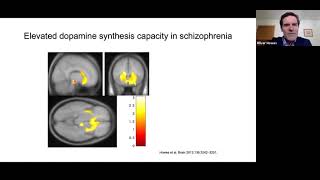 Going beyond 60 years of D2 blockers new treatments for psychosis [upl. by Airun]