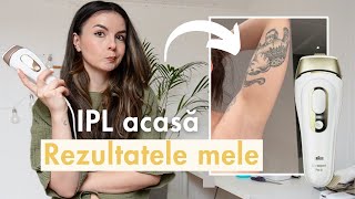 Epilarea definitivă acasă funcționează Review Braun IPL Pro 5 vs Phillips Lumea  Rezultate ipl [upl. by Toogood]