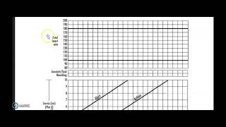 Opening a Partograph  How it is done [upl. by Eveline]