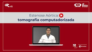 Estenose Aórtica Tomografia computadorizada [upl. by Divine]