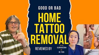 Home tattoo Removal Using Salt Reviewed by Dr Messina amp Dr Youn Is It Safe [upl. by Elison]