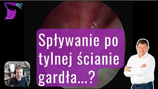 Spływanie po tylnej ścianie gardła — alergia zatoki czy refluks [upl. by Brownson435]