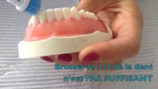 Technique de brossage des dents avec brosse  à dent électrique – Dr Rania Azzi Parodontiste [upl. by Bruis]