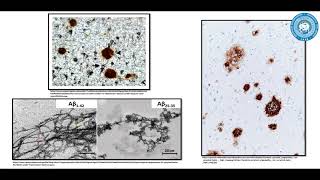 Glymphatic system and associations with diseases Students Lectorium [upl. by Weinstein566]