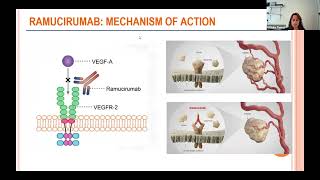 Clinical Trials for Thymic Tumors 2024 Update [upl. by Lela446]