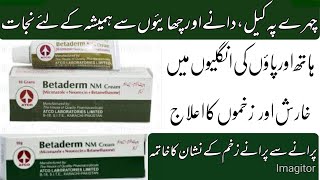 Betaderm NM cream use in Urdu [upl. by Yunick]