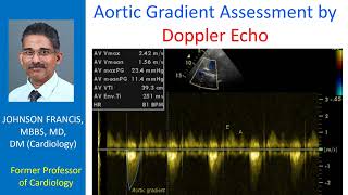 Aortic Gradient Assessment by Doppler Echo [upl. by Vincenty435]