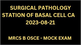 SURGICAL PATHOLOGY STATION OF BASAL CELL CA [upl. by Sigismund]