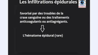 infiltration epidurale les risques et les voies dabords de infiltration epidurale [upl. by Nohtiek]