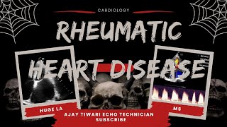 RHEUMATIC HEART DISEASERHDCardiology [upl. by Davis]