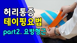 옆구리 아플때 허리통증 테이핑 part2 요방형근 Lower back pain QL area Kinesio Taping [upl. by Atterbury]