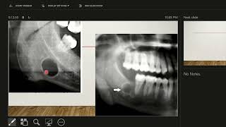 Lecture 2 Lesion Characteristics and Description [upl. by Adnala]