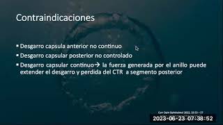 Debilidad Zonular Dr Juan Camilo Cadavid 20230623 [upl. by Ahsiet]