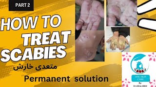 How to treat scabiespermanent solutionskin contagious infection ‎skinhealthvitality5959 [upl. by Hareenum193]