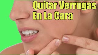 ¿Quieres Eliminar Las Verrugas Planas En La Cara Mira Estos Remedios Naturales [upl. by Dicky461]