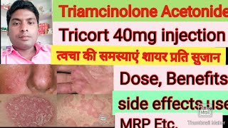 Tricort 40 injection Triamcinolone Acetonide 40mg injection Review in Hindi [upl. by Horwath]