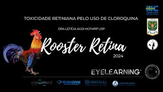 Toxicidade retiniana pelo uso de cloroquina com Dra Letícia Audi Fellowship Retina e Vitreo  HCFMRP [upl. by Lyrahc]