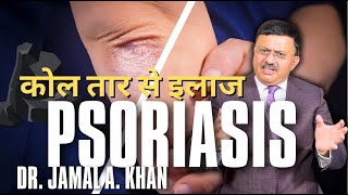 Psoriasis Causes Triggers and Treatments  Dr Jamal A Khan [upl. by Norward]