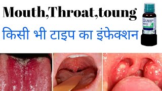 Betadine Gargle 2 Mouth amp throat infection Bacterial and fungal infection in mouth [upl. by Yanrahs]