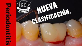 NUEVA CLASIFICACIÓN PERIODONTAL  CÓMO SE CLASIFICA LA PERIODONTITIS Actualización periodoncia [upl. by Jary]