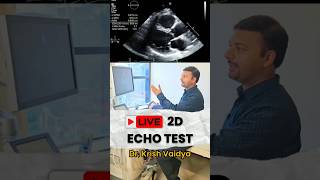 Live 2D Echo cardiography test heart echo live shorts shortsfeed short drkrishvaidya trend [upl. by Reichel155]