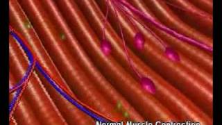 Mechanism of Botulinum Toxin [upl. by Anayeek]