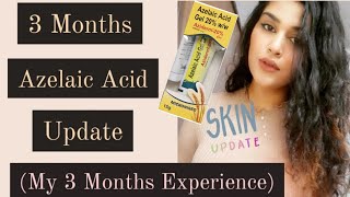 3 Months Azelaic Acid Update  My Experience with Azelaic Acid aziderm AzelaicAcid acnetreatment [upl. by Jeniece946]