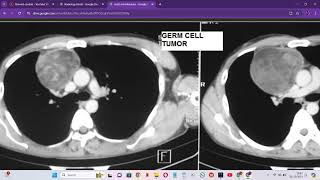 RADIOLOGY EXAM CASES [upl. by Faydra]