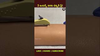 Contraceptive implant🤰youtubeshorts factsintelugu shortsfeed [upl. by Quiteri440]