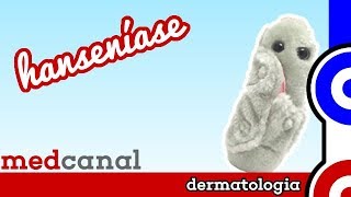 Hanseníase  DERMATOLOGIA [upl. by Hazeghi]