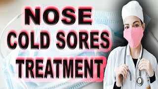 nose cold sores treatment [upl. by Vivi47]