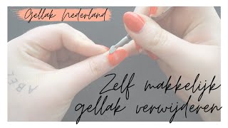 GELLAK VERWIJDEREN  Uitgebreide uitleg  Gellak Nederland [upl. by Niemad]