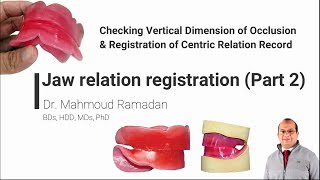 21 Jaw relation registration Part 2 Vertical Dimension of Occlusionamp Centric Relation Record [upl. by Gualtiero234]