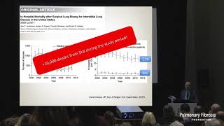 Utility and Options for Lung Biopsy  Fabien Maldonado MD [upl. by Nnyla]