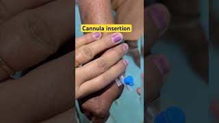 Cannula insertion of old female patient nurses cannula youtubeshorts shorts ytshorts doctor [upl. by Dallas677]