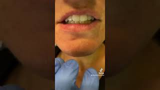 Are you flossing properly  Flossing 101  How To Floss dentistry dentist dentalhygienist [upl. by Zaob701]