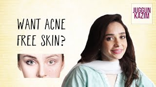 Get Rid of Acne and Acne Scars  Techniques to Get Glowing Skin  Juggun Kazim [upl. by Candi833]