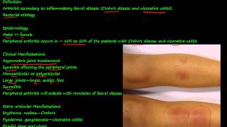 100P  Enteropathic Arthropathy [upl. by Yelyac606]